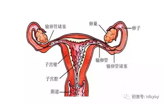 因为输卵管子宫等输卵管邻近的器官手术导致的女性输卵管感染导致女性