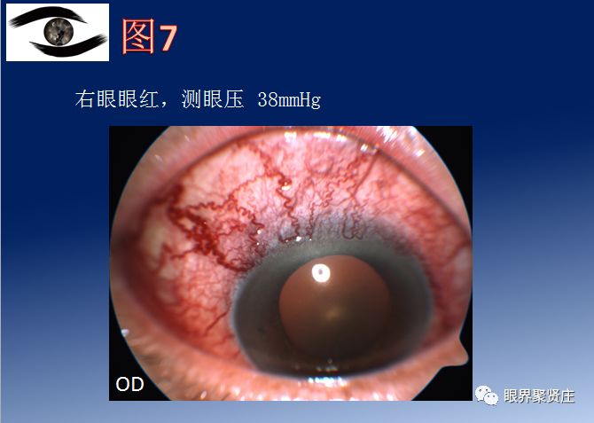 看图识病九宫格系列|眼睑眼眶病