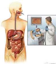 胃,十二指肠表面黏膜的过程,检查的同时可以通过胃镜内部的孔道进行