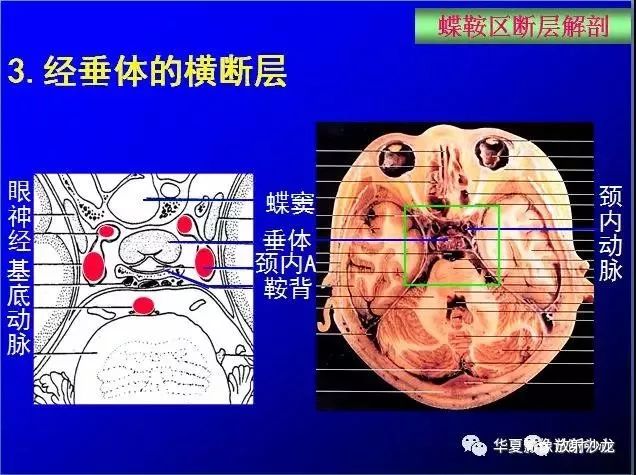 这么全的鞍区影像解剖赶紧收藏备用