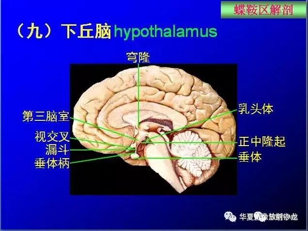 这么全的鞍区影像解剖,赶紧收藏备用!