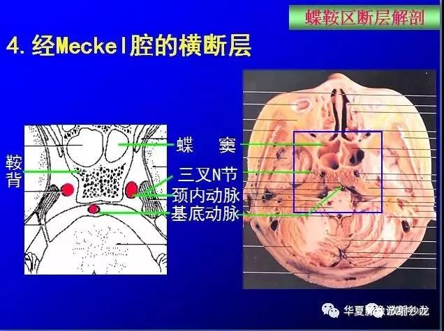 这么全的鞍区影像解剖,赶紧收藏备用!