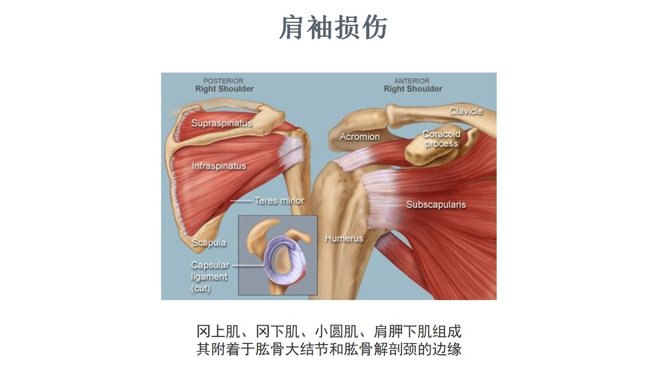 肩袖损伤?运动损伤,术后修复,疼痛解决全攻略!附视频