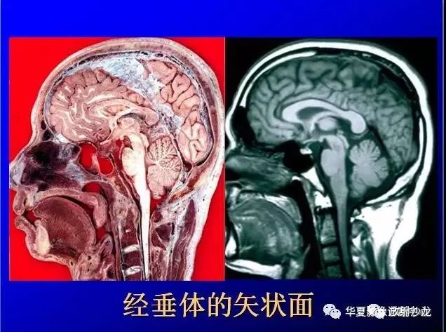 这么全的鞍区影像解剖,赶紧收藏备用!