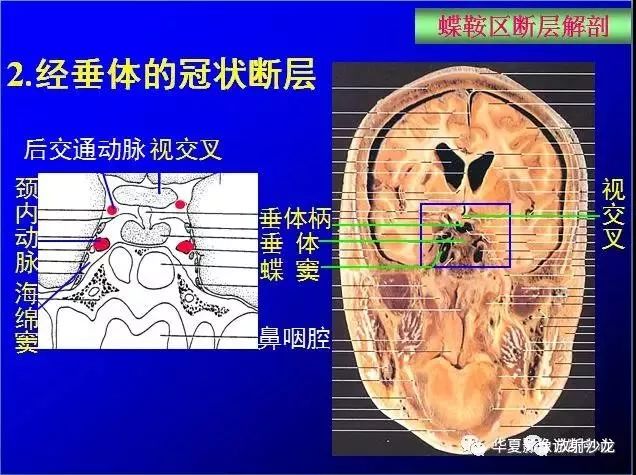 这么全的鞍区影像解剖,赶紧收藏备用!