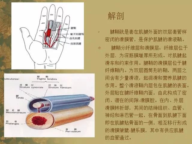 推荐| 狭窄性腱鞘炎的治疗策略