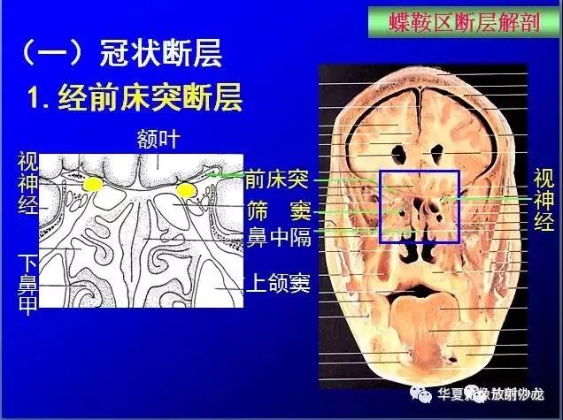 这么全的鞍区影像解剖,赶紧收藏备用!