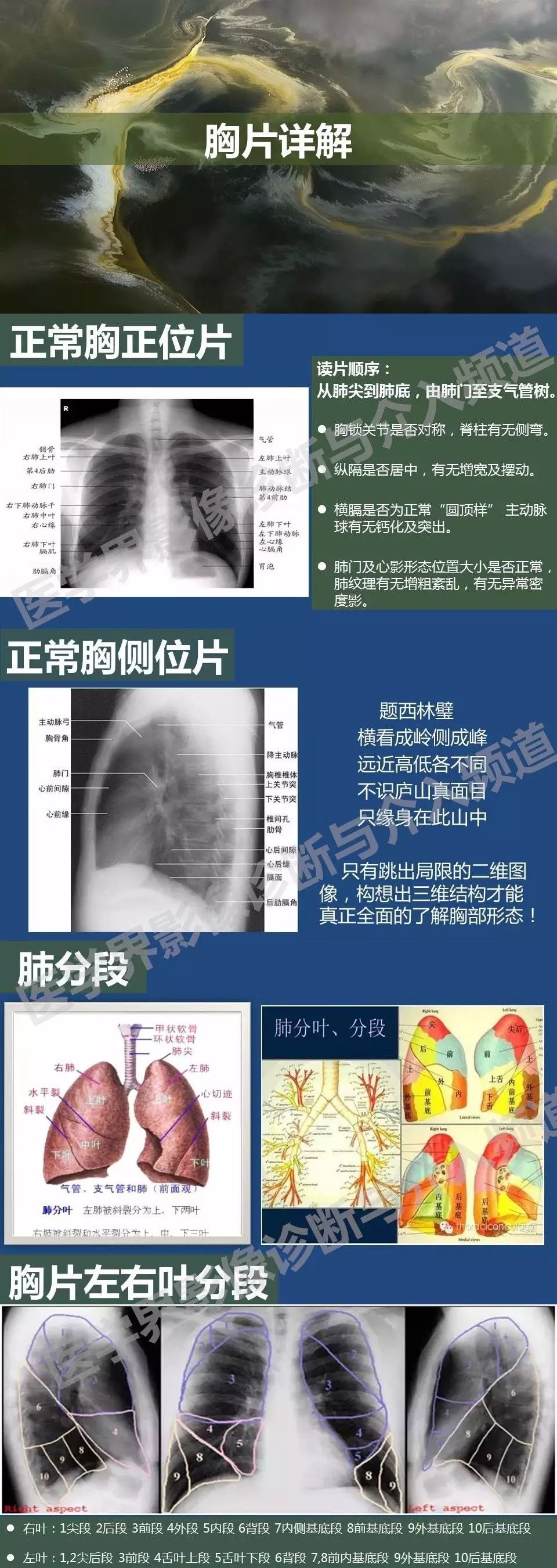 各种肺疾病胸片重点全在这里啦