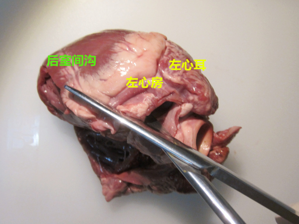 各个大血管在这么靠近心脏的地方切断,真的是让人很难受啊,都快分不清