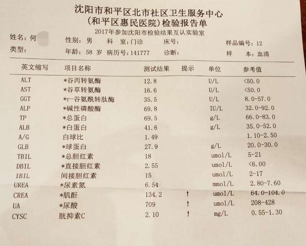 仅治疗一个月手肘处两次共排出五针管液化痛风石