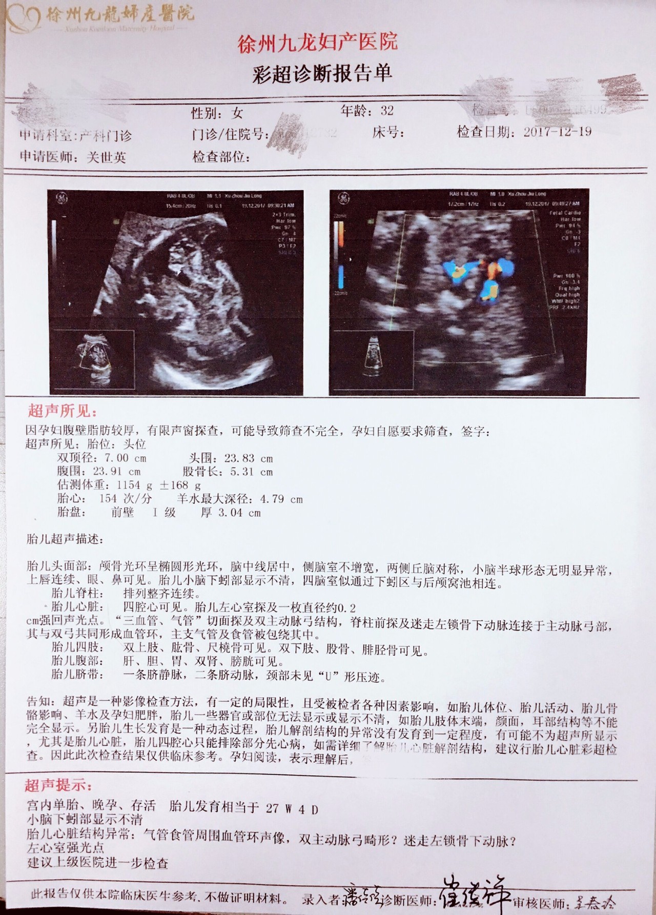 (罕见先天性心脏病)