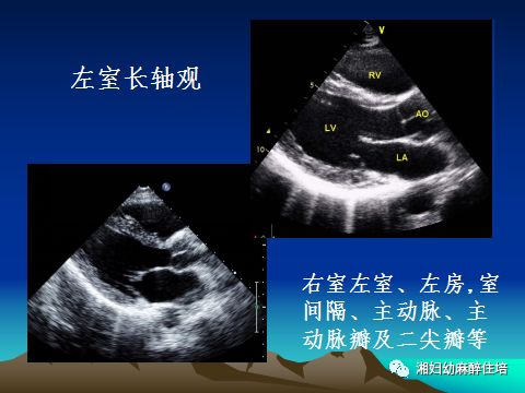 1954年首次应用超声诊断心脏病.