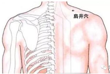 2),肩井主要以疼痛明显的部位为主.