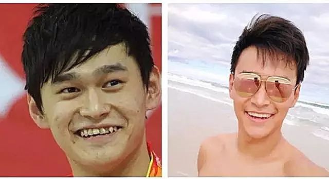 奥运冠军孙杨,曾经因为牙齿不整齐,惨被戏称为"鲨鱼牙".