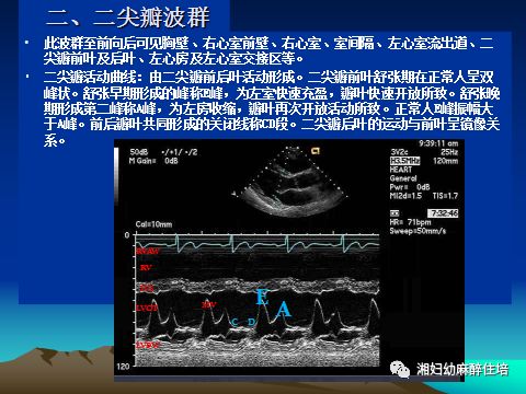 临床常用的有三种:m型,二维和多普勒超声心动图.