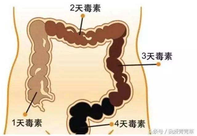 放屁又臭又多怎么办