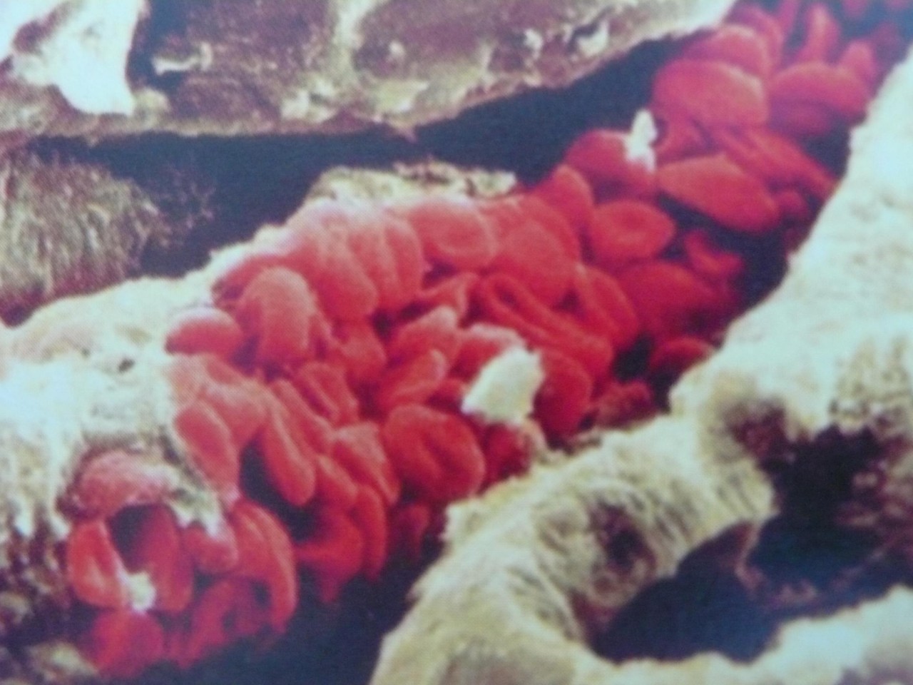血管中的红细胞(电镜扫描)
