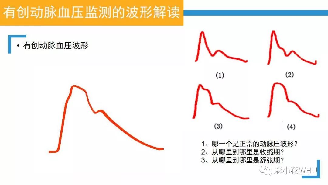 测量动脉血压的原理是什么_肱动脉测量血压图片