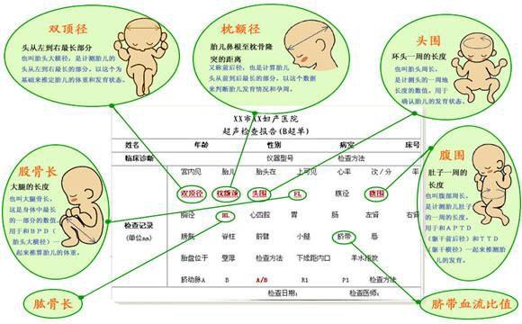 怀孕一个月你身体正悄悄地发生这些变化,敏感期不注意