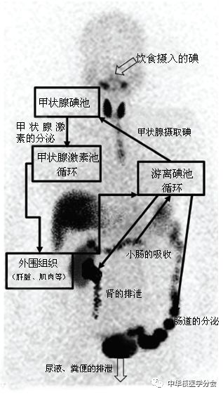 碘代谢示意图