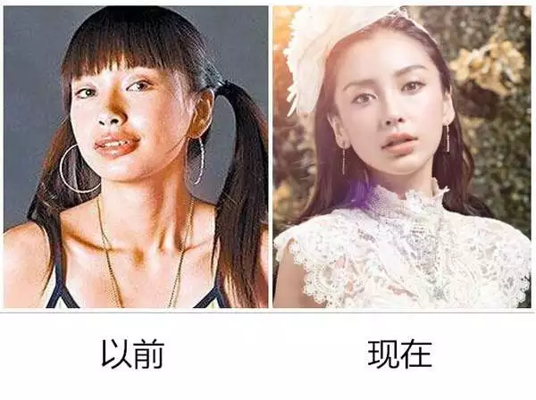 angelababy鉴定未整容 只能说:美学矫正改变命运