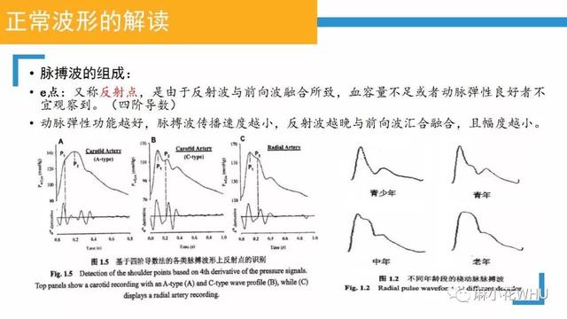 测量动脉血压的原理是什么_肱动脉测量血压图片