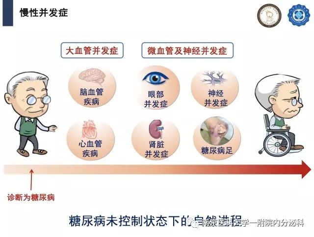 慢性并发症糖尿病酮症酸中毒2低血糖1急性并发症1型糖尿病并发症分为