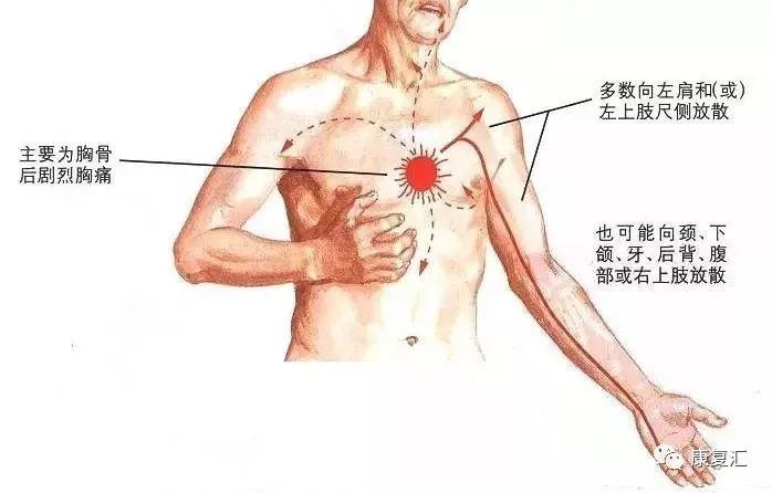 很巧的是,左肩部,左侧小指以及胸骨等部位的痛觉传导与冠心病信号传导