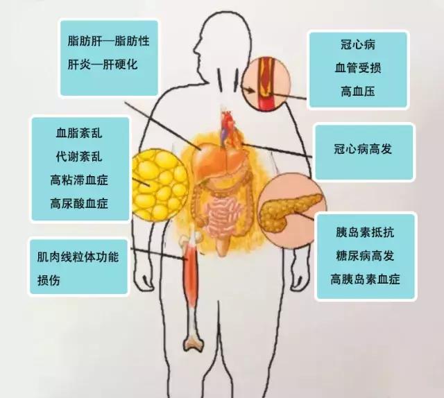 脂肪肝伤肝,伤心,伤胰腺,伤不起!