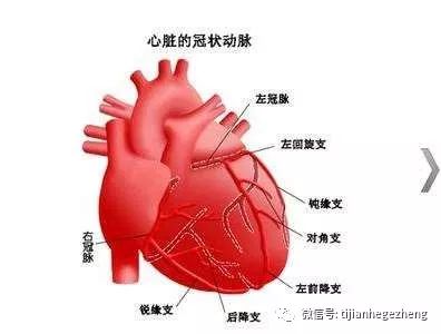 行心脏多排螺旋ct检查显示前降支和回旋支病变,遂行冠状动脉造影检查