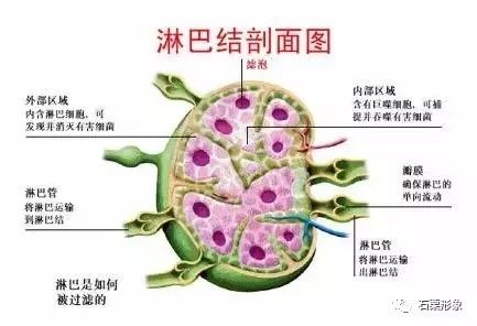 改善副乳,腋下淋巴偏黑,腋下淋巴结变小.