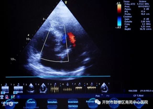 转氨酶200多怎么办