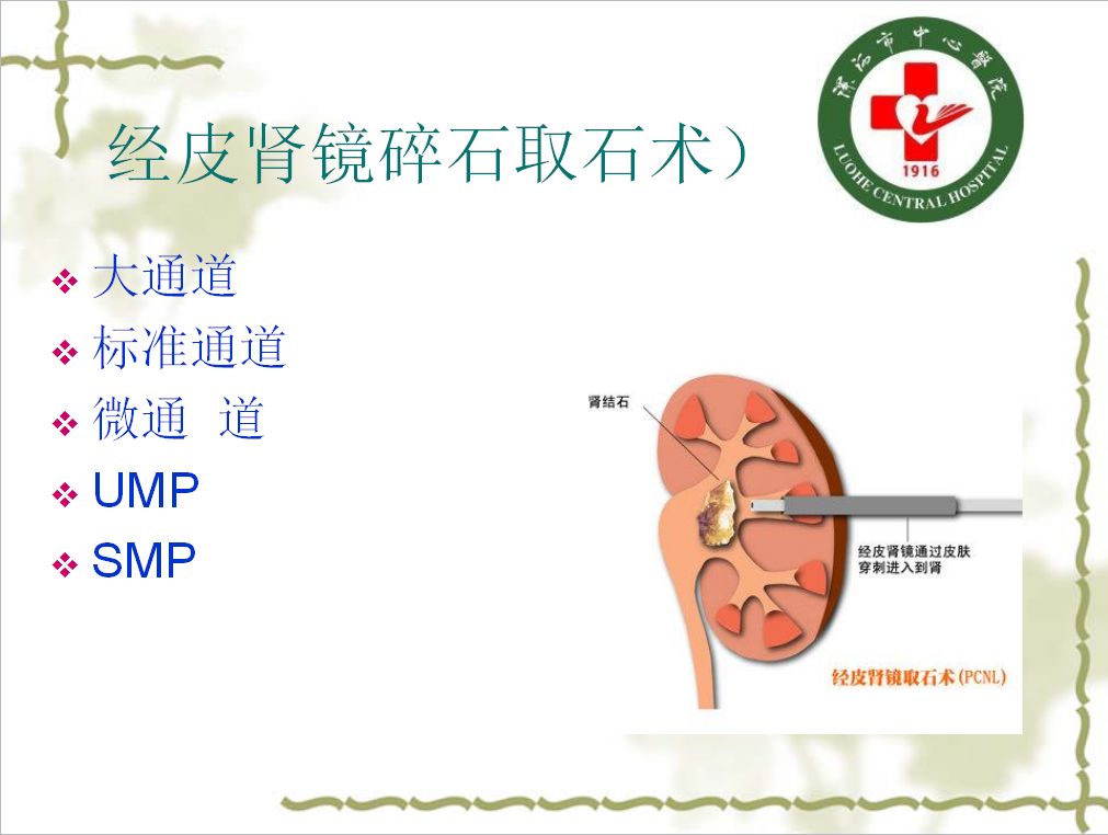 结石 直肠指诊可能发现后尿道结石 b型超声 x线检查 治疗 舟状窝结石