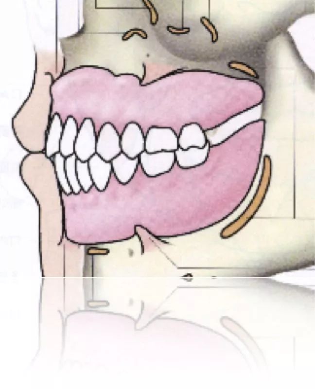 所以可以看到义齿和内外斜线的这样的一个关系,这些图都是来自于日本