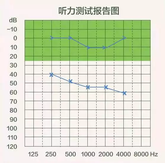 如何识别香蕉图和听力图