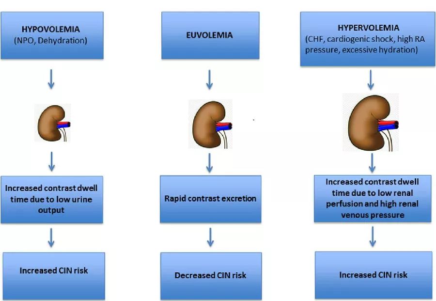 预防造影剂急性肾损伤静脉水化越多越好
