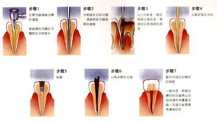 十几岁牙齿烂了怎么办