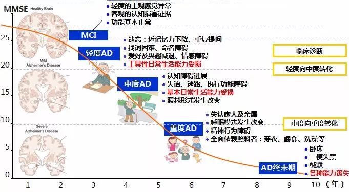 远离记忆杀手阿尔茨海默症我们应该怎么做