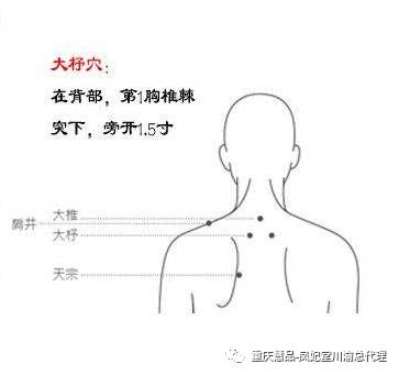 大杼穴——颈椎病克星