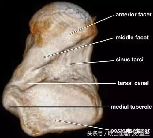 距骨颈的下表面形成跗管,通到跗骨窦横蝌.