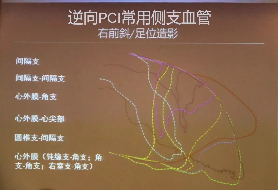 ccc&cisc2018 | 张奇:如何评估侧支,哪些可用于逆向pci?