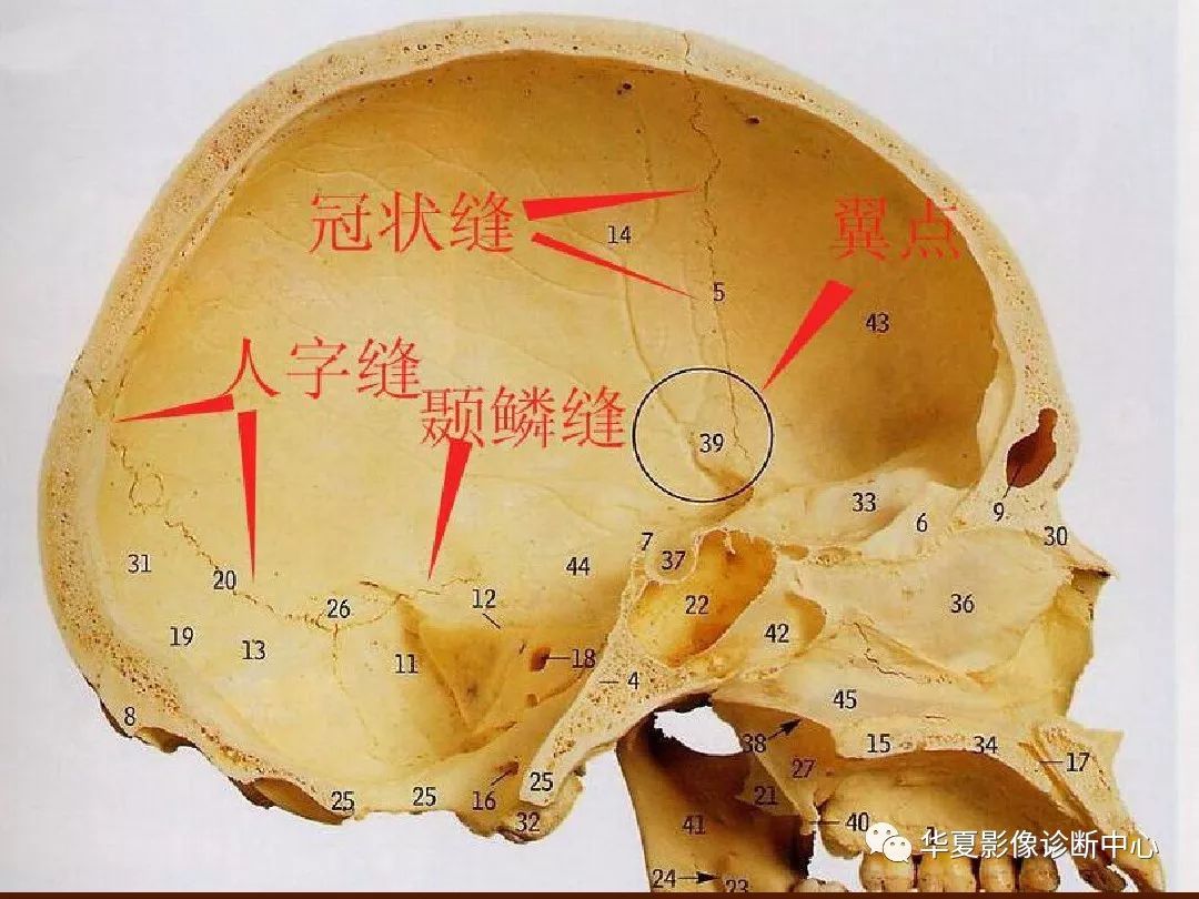 最全的颅骨ct解剖及外伤骨折的诊断