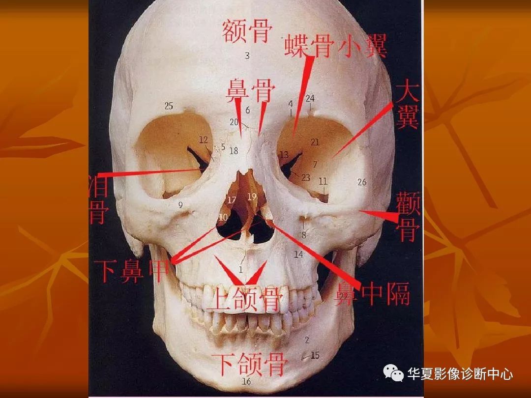 最全的颅骨ct解剖及外伤骨折的诊断