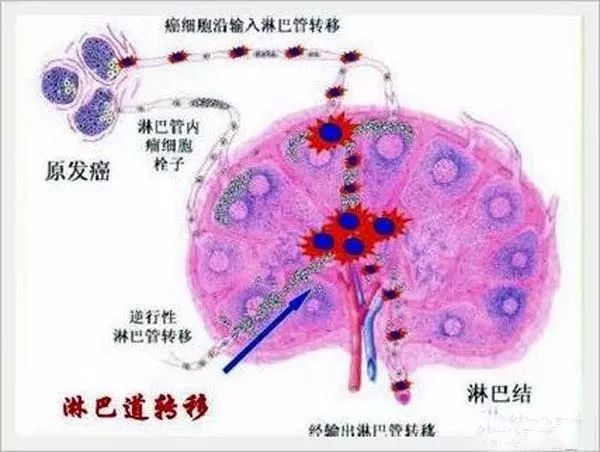 身体有极丰富的淋巴组织,其淋巴管和淋巴液构成淋巴循环系统分布于