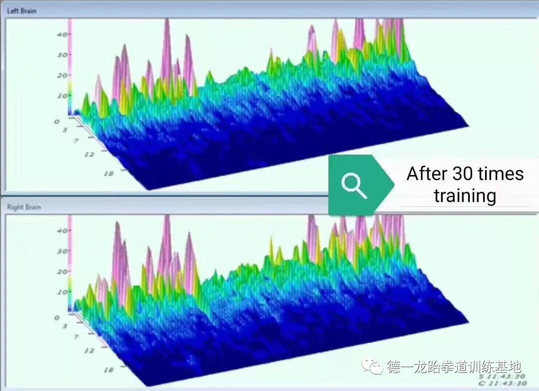 神经反馈,脑波检测.