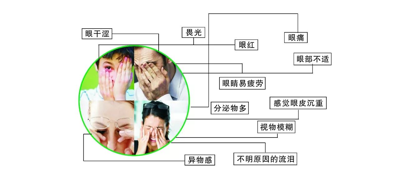 干眼症症状