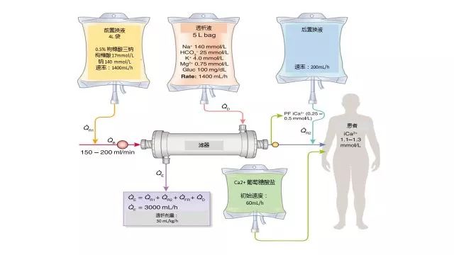 图 1 持续性静脉 - 静脉血液透析滤过 (cvvhdf) 总的来说,对于 aki