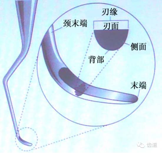 匙形刮治器工作端的角度: 通用刮治器 面特异型刮治器如gracey刮治 