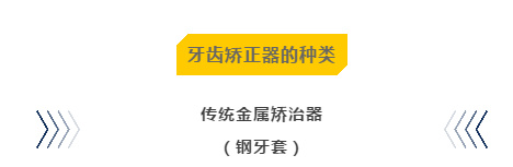 牙齿矫正器到底该如何选择