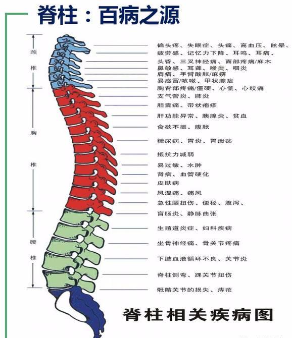 他们认为没有发生脊椎移位的脊柱是没有的,只不过有人处于代偿期,而无